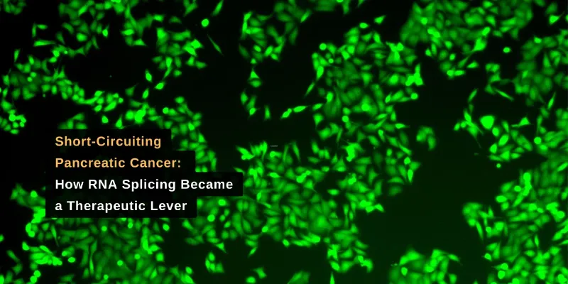 Rewiring RNA: Antisense RNA Therapy Exposes a New Weakness in Pancreatic Cancer