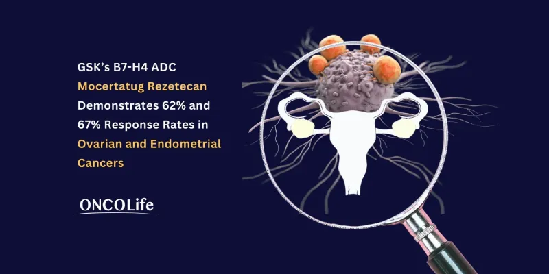 Mocertatug Rezetecan Shows Strong Responses in Ovarian and Endometrial Cancers