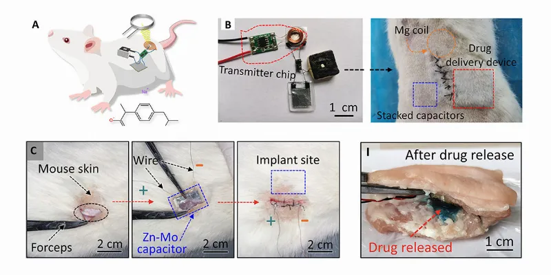 How Soft Supercapacitors Could Transform the Future of Implantable Medical Devices?