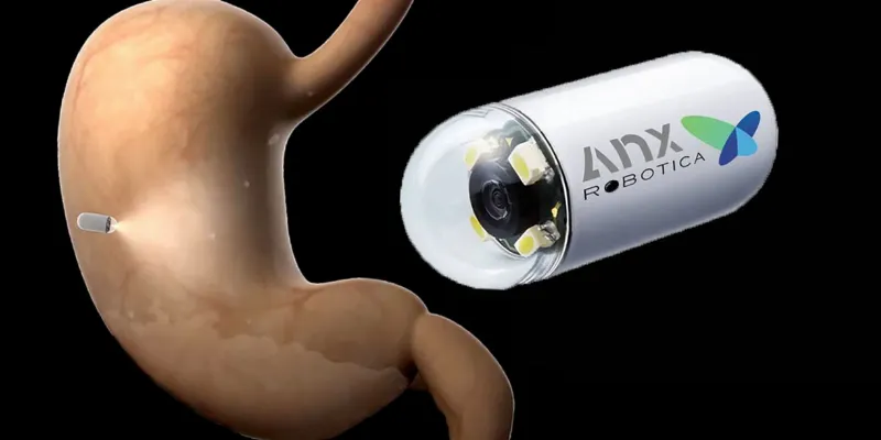 The First AI-Assisted Video Capsule Endoscopy: FDA Approves AnX Robotica's ProScan