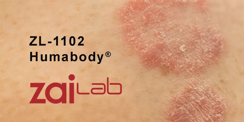 Zai Lab Advances Psoriasis Treatment with ZL-1102 Topical Therapy in Phase 2 Trial