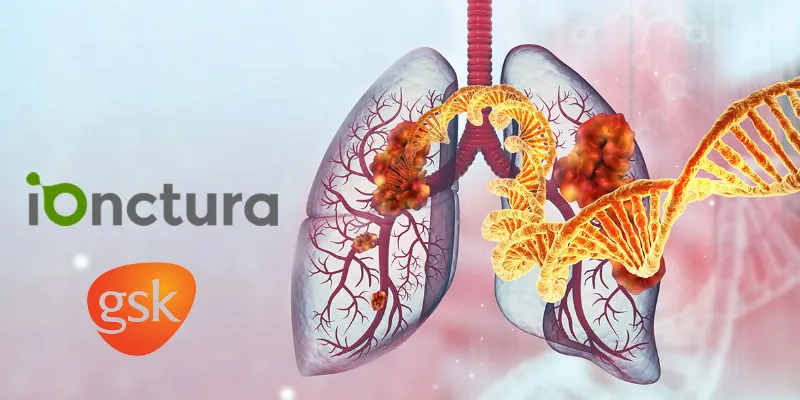 iOnctura and GSK Collaborate to Advance NSCLC Therapy with Roginolisib Trials