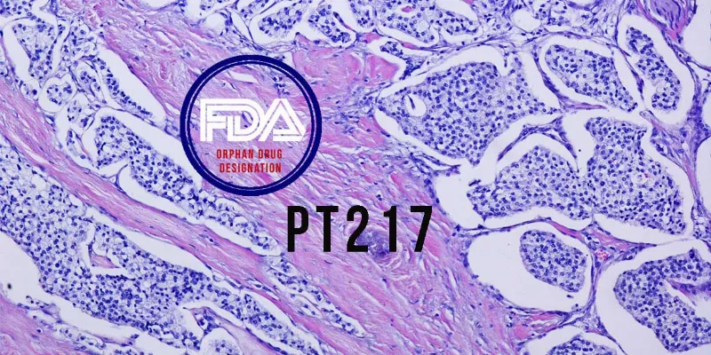 Novel Cancer Drug PT217 Wins FDA Orphan Drug Status for Neuroendocrine Carcinoma