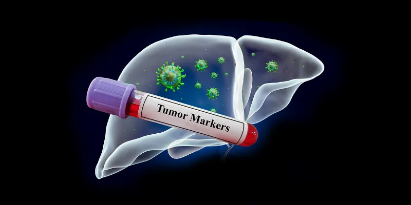 Targeting NBR1: New Biomarker Could Predict Immunotherapy Success in Liver Cancer