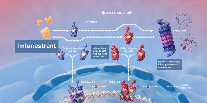 Imlunestrant Shows Promising Results Alone and with Verzenio in ER+, HER2- Breast Cancer