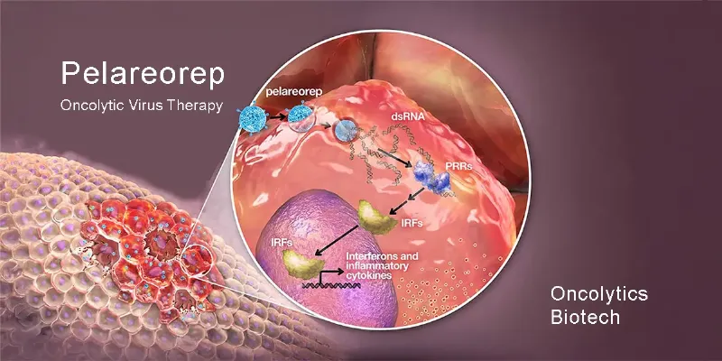 Regulatory Approval Advances Pelareorep’s Oncolytic Virus Therapy for Pancreatic Cancer