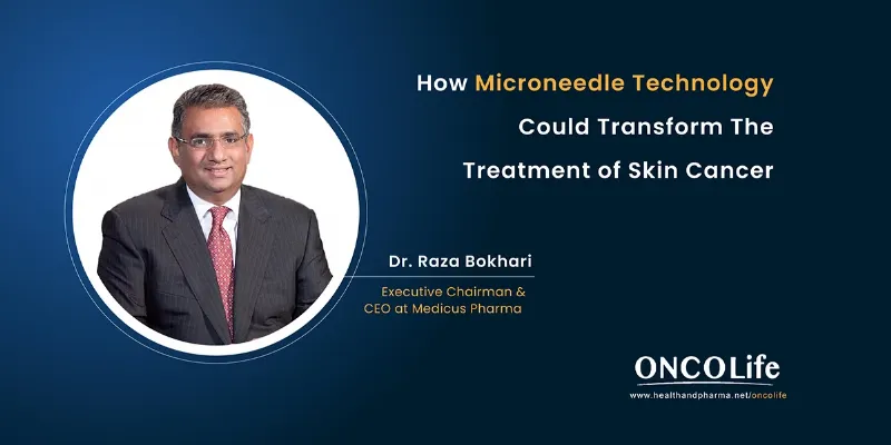 How SkinJect's Microneedle Technology Could Transform the Treatment of Skin Cancer