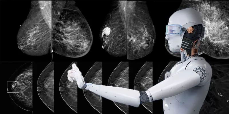 AI Shows Equal Accuracy as Radiologists in Breast Cancer Screening